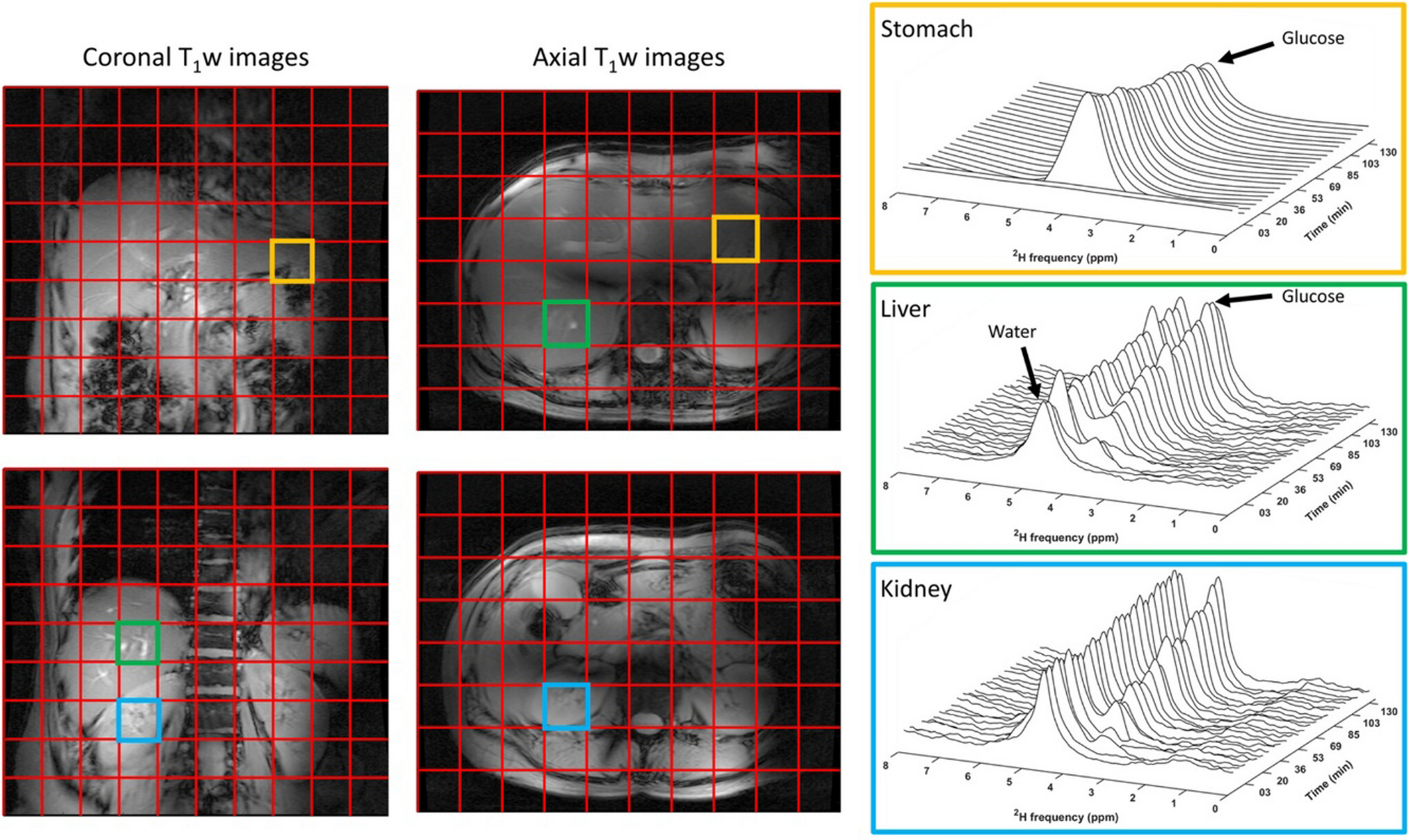 Deuterium metabolic imaging beyond the brain: mapping tissue metabolism across the body