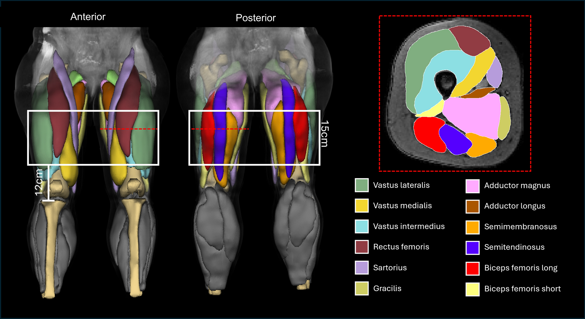 Standardizing quantitative muscle MRI: an inter-vendor evaluation in healthy adults