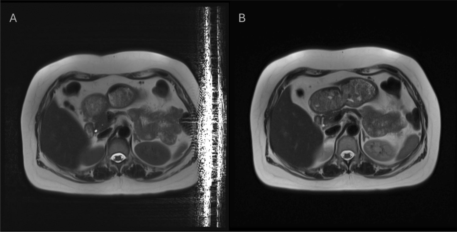 MRI faraday cage performance during the lifetime of clinical MRI systems