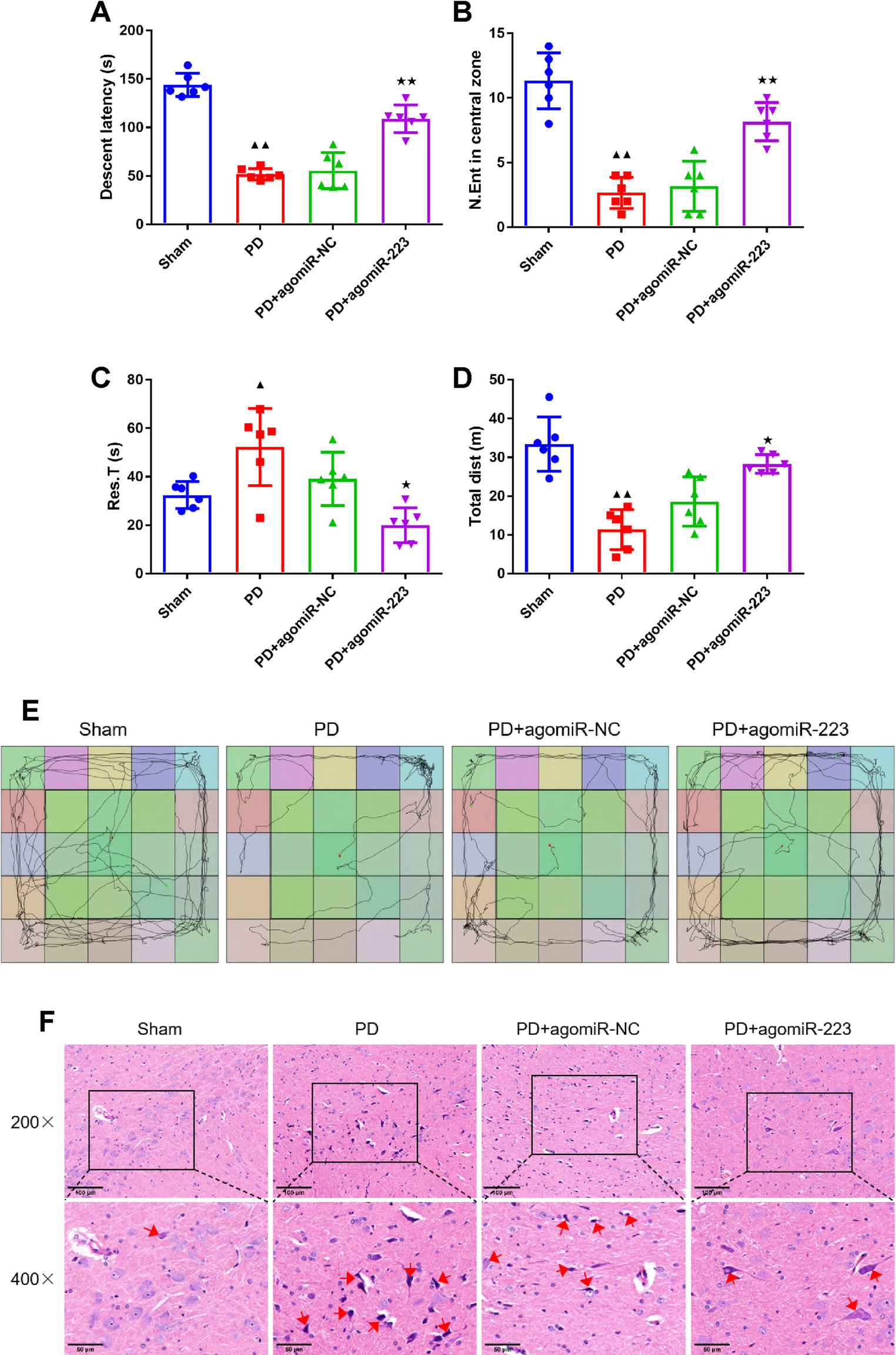 Activation of mitophagy via miR-223/NLRP3 axis ameliorates dopaminergic neuronal damage in parkinson’s disease
