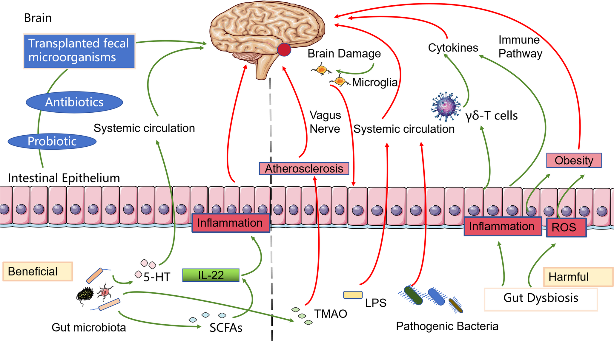 Ellagic acid can improve stroke by regulating gut microbiota