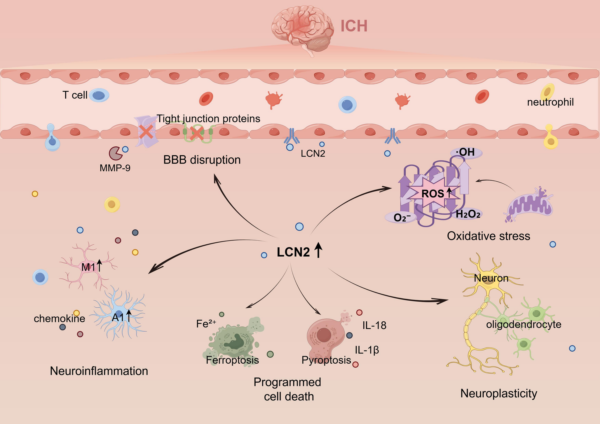 Lipocalin-2 in Intracerebral Hemorrhage: Mechanisms, Biomarker Potential, and Therapeutic Targeting