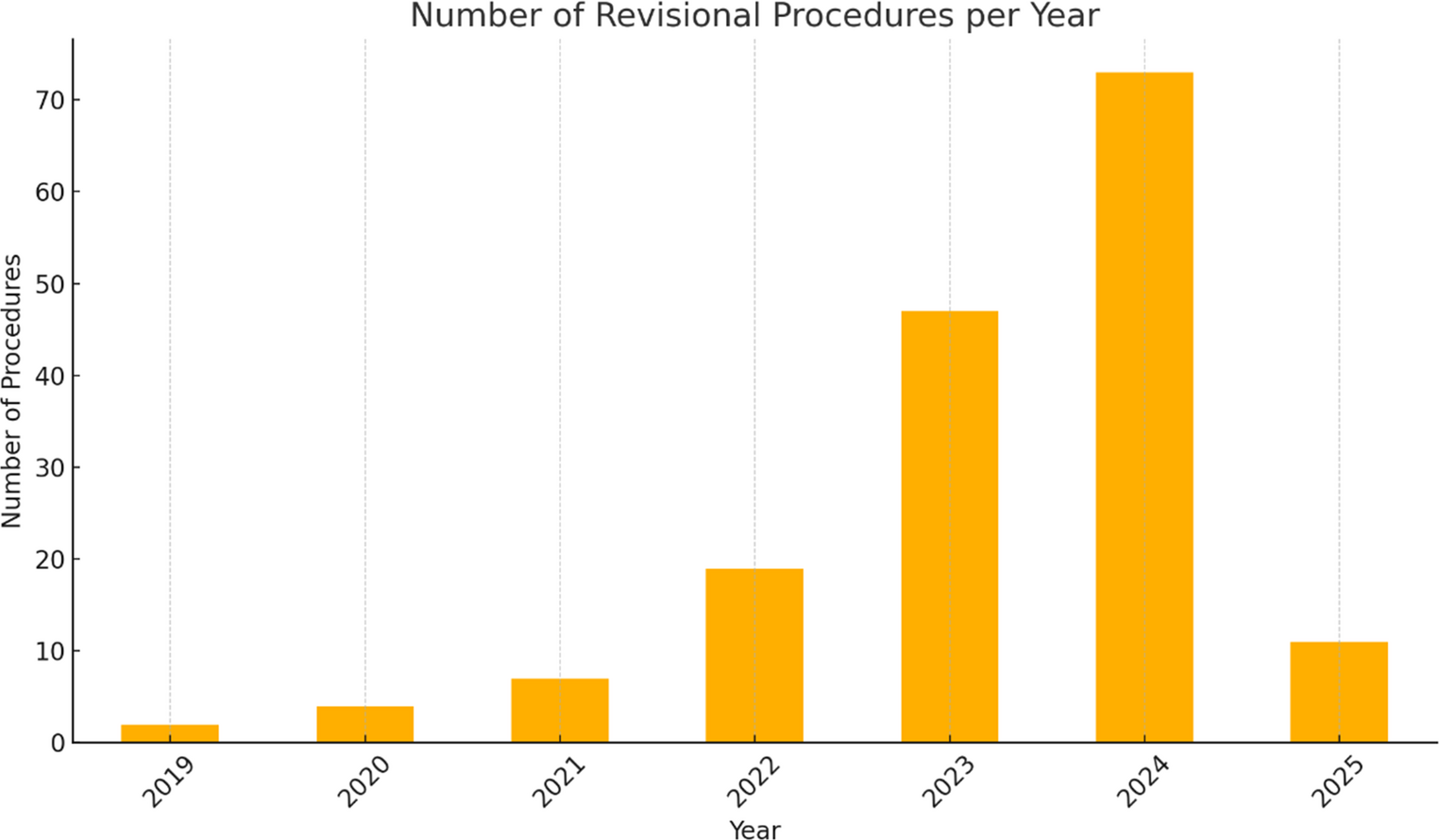 Combined Proximal Revision and Moderate Distalization After Roux-en-Y Gastric Bypass: A Retrospective Single-Center Case Series