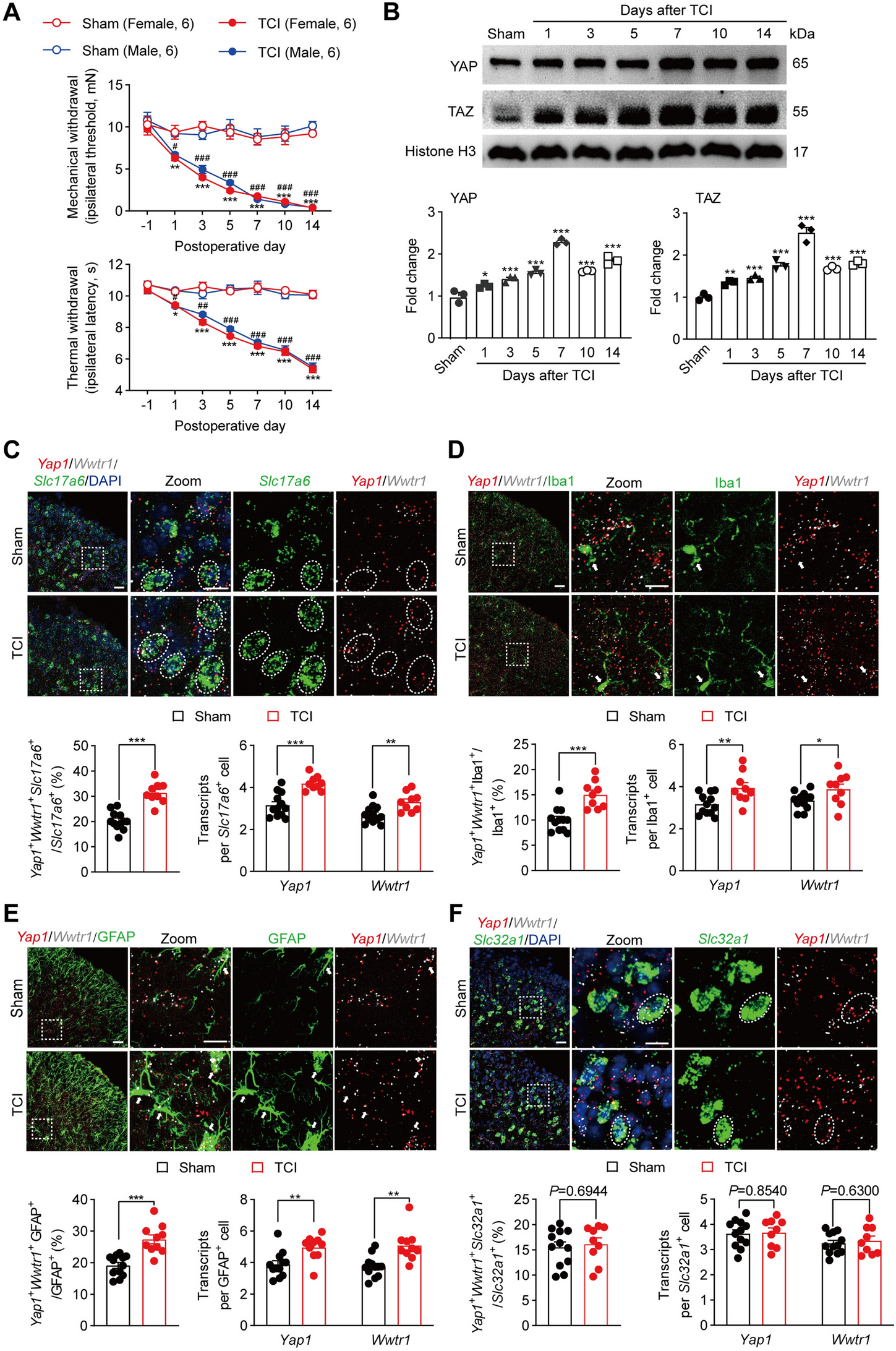 Neuronal and Glial YAP/TAZ in the Spinal Cord Contribute to the Development of Bone Cancer Pain in Mice