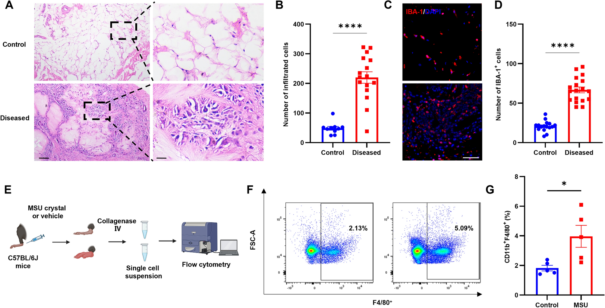 Tissue-Resident Macrophage PIEZO1 Transduces Mechanical Stress into Inflammatory Pain in Acute Gout