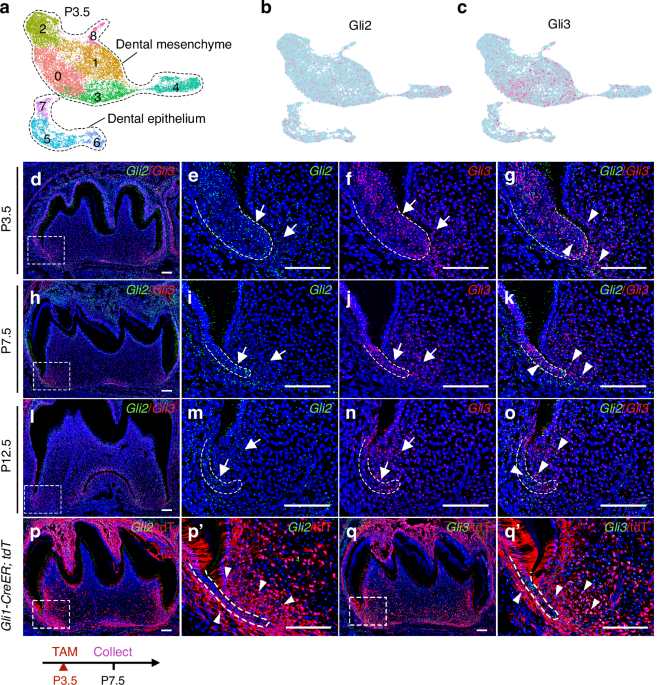 Gli2 and Gli3 synergistically mediate HH-TGF-β crosstalk in mesenchymal progenitor cells to orchestrate tooth root morphogenesis