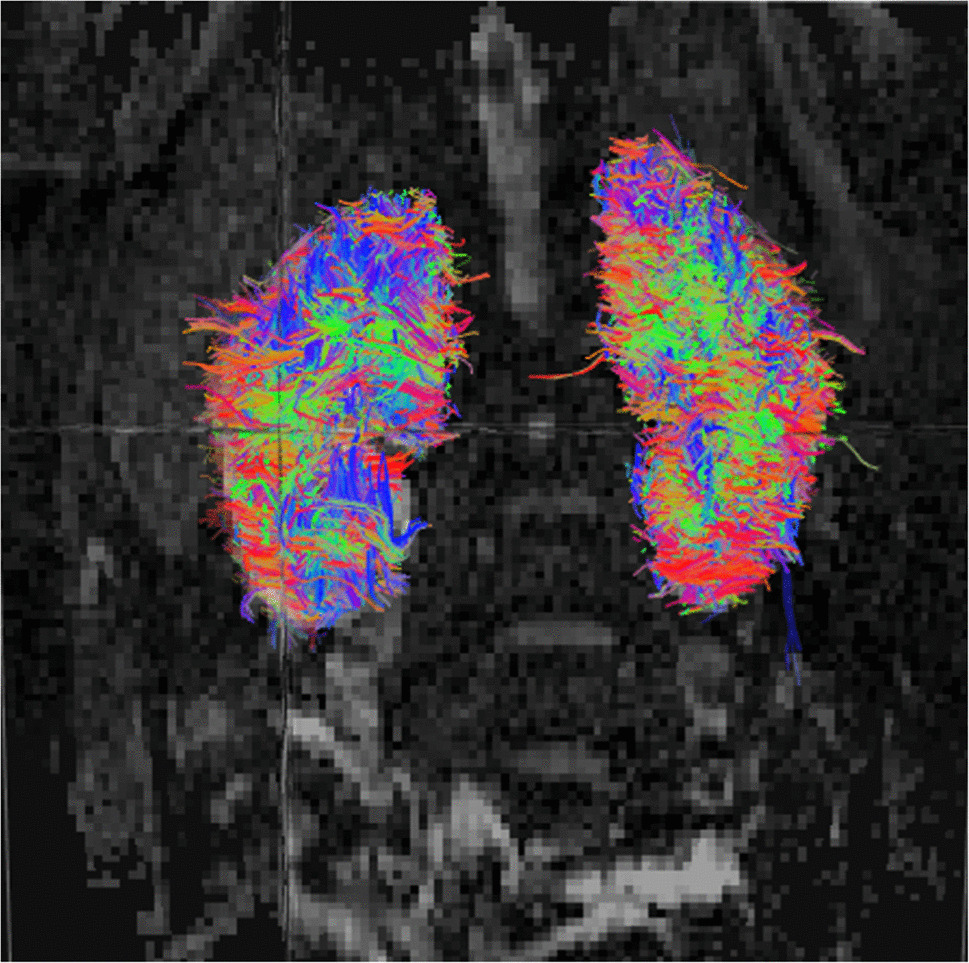 Advances in pediatric kidney diffusion tensor imaging: diagnostic and functional applications