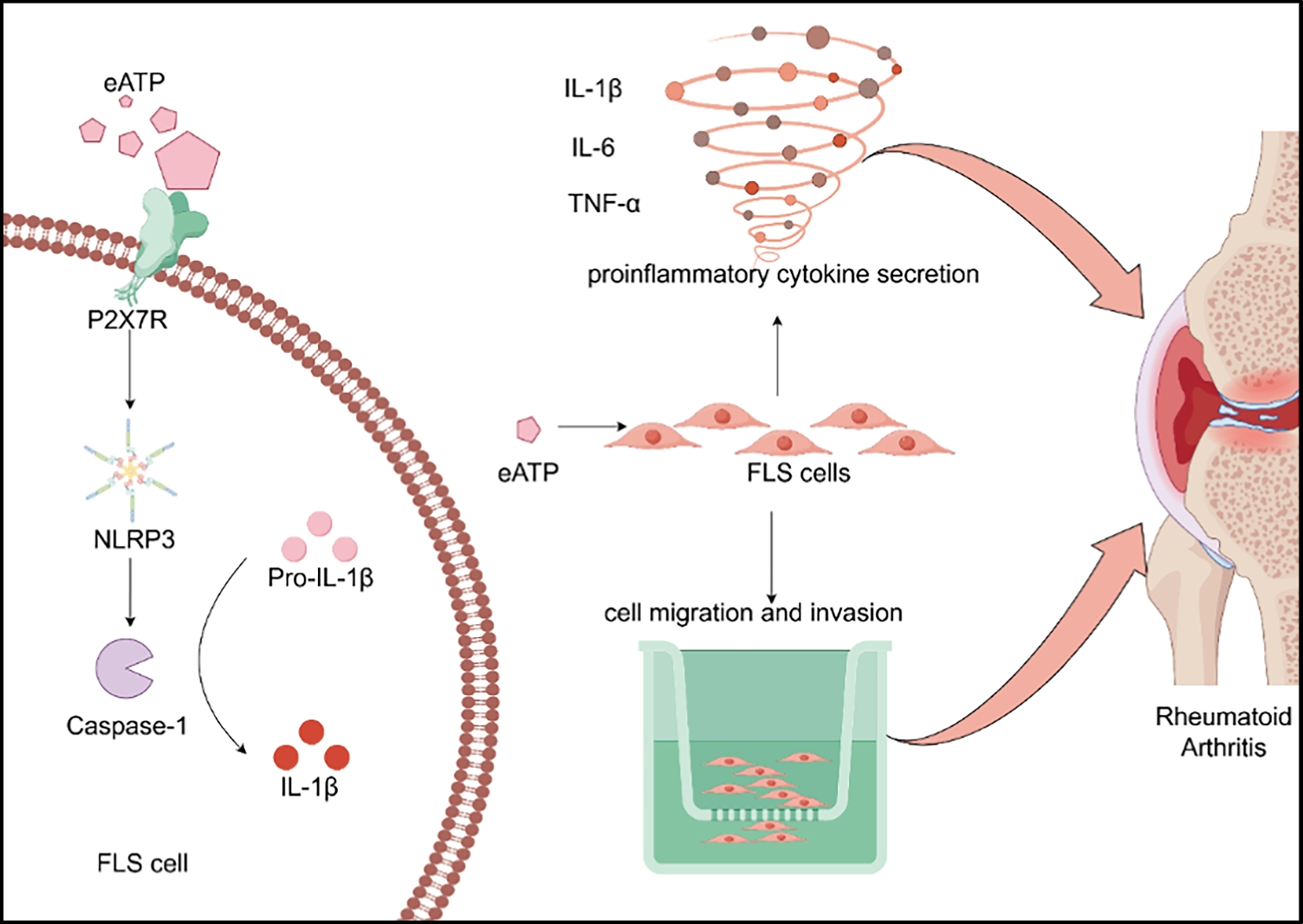 Extracellular ATP induces the proinflammatory phenotype transition of MH7A cells by activating P2X7 receptor