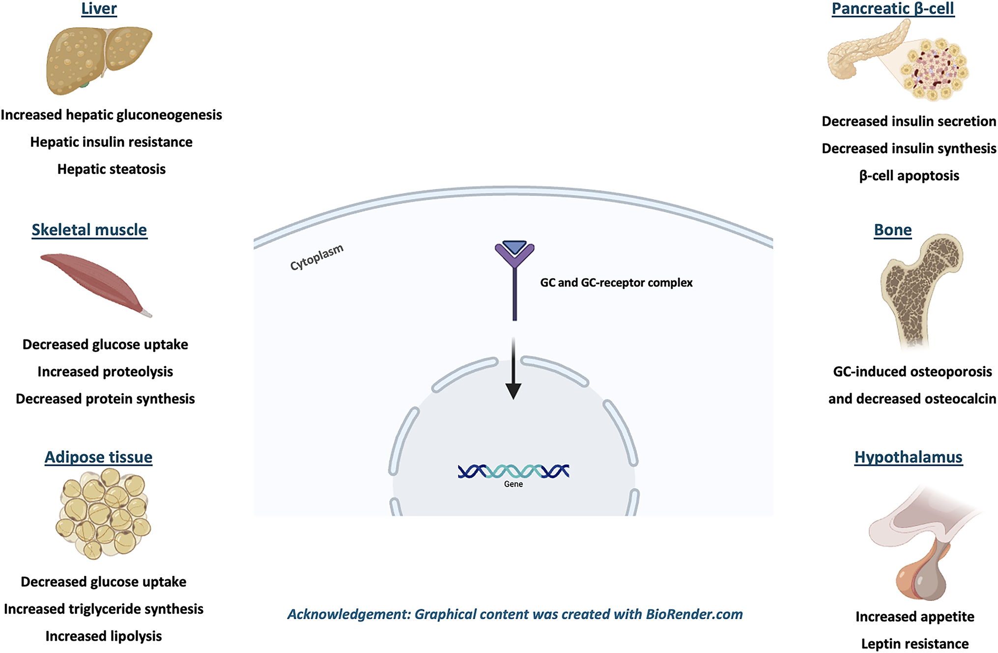 Glucocorticoid-induced diabetes mellitus: mechanisms, risk factors, and clinical pathways with insights from autoimmune rheumatic diseases