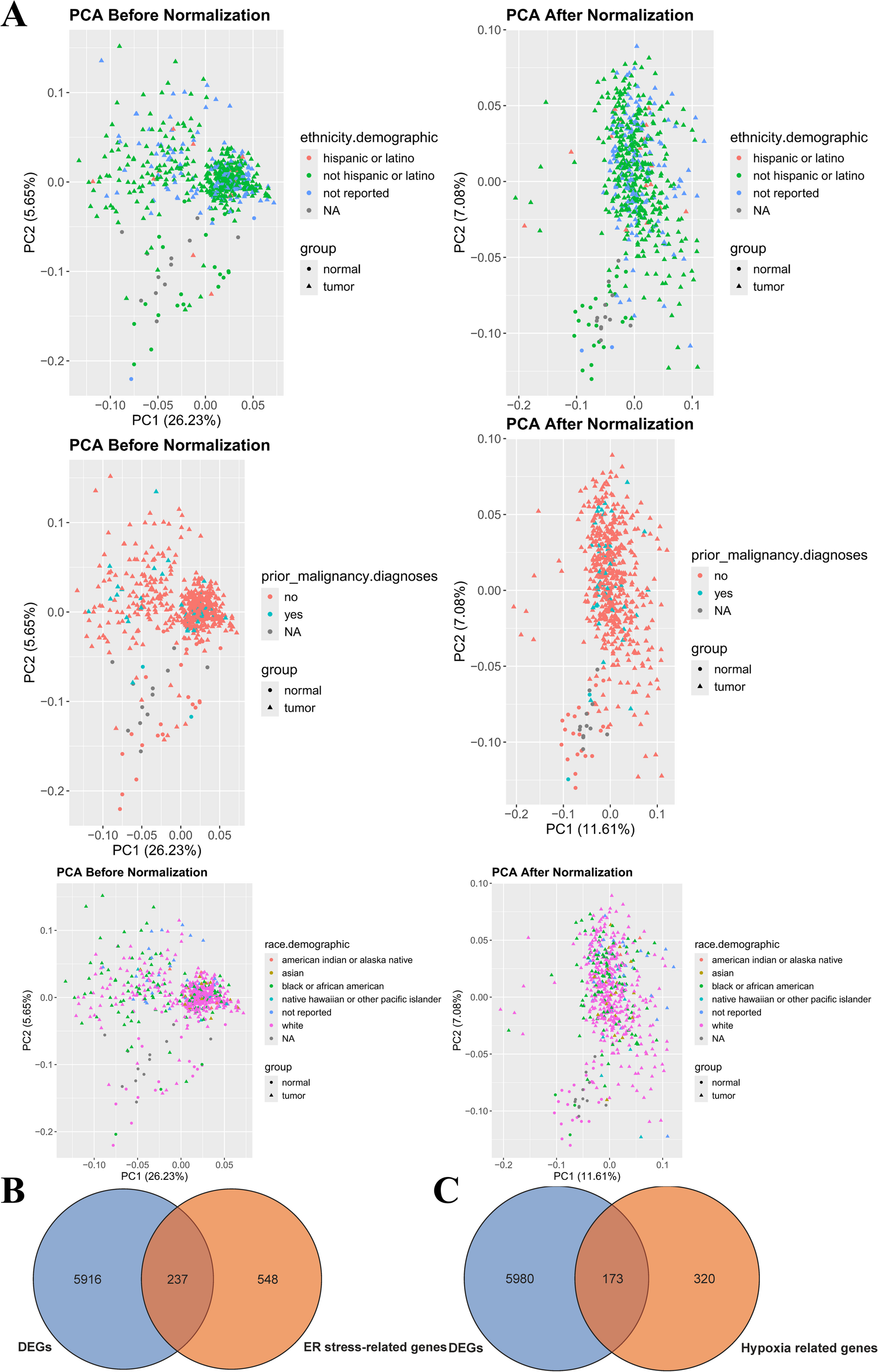 The Model Related to Hypoxia and Endoplasmic Reticulum Stress Predicting Prognosis and Immunotherapy Response in Uterine Corpus Endometrial Cancer