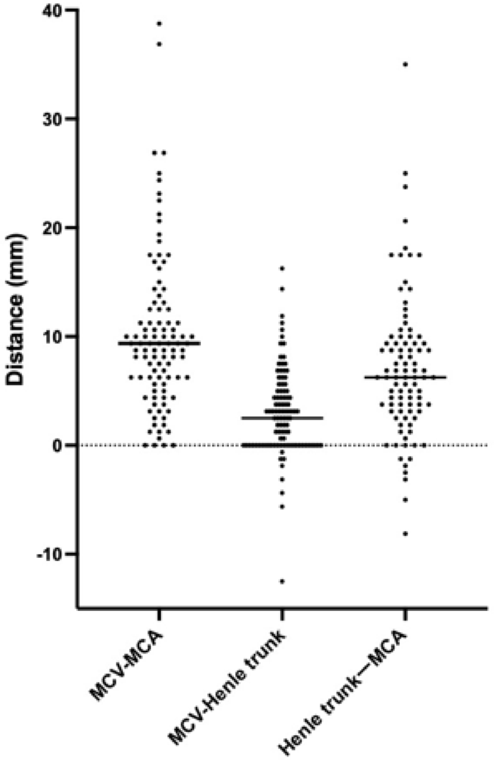 Revisiting the anatomical relationship between the middle colic artery and the middle colic vein for complete mesocolic excision in colon cancer surgery