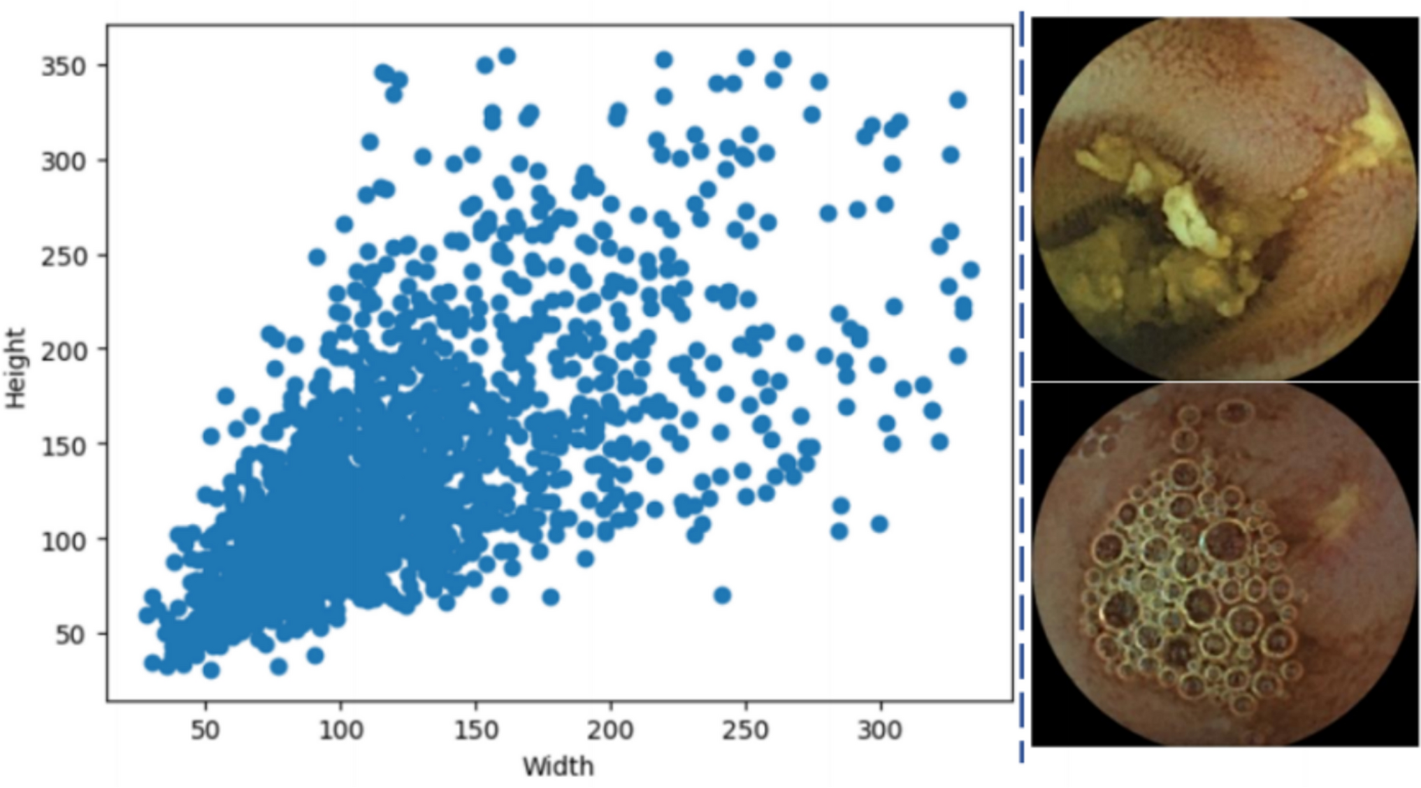 Improving Crohn’s disease lesion detection in capsule endoscopy with an advanced feature pyramid network