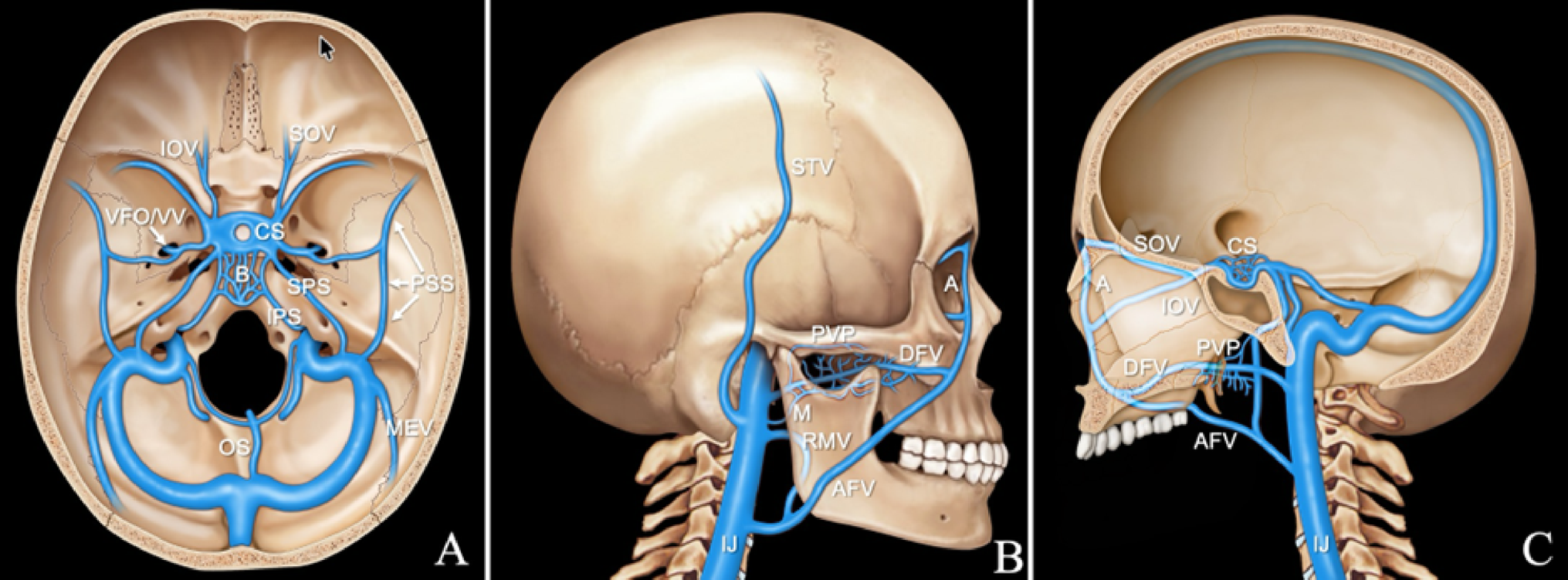 Clinical and surgical implications of emissary venous anatomy