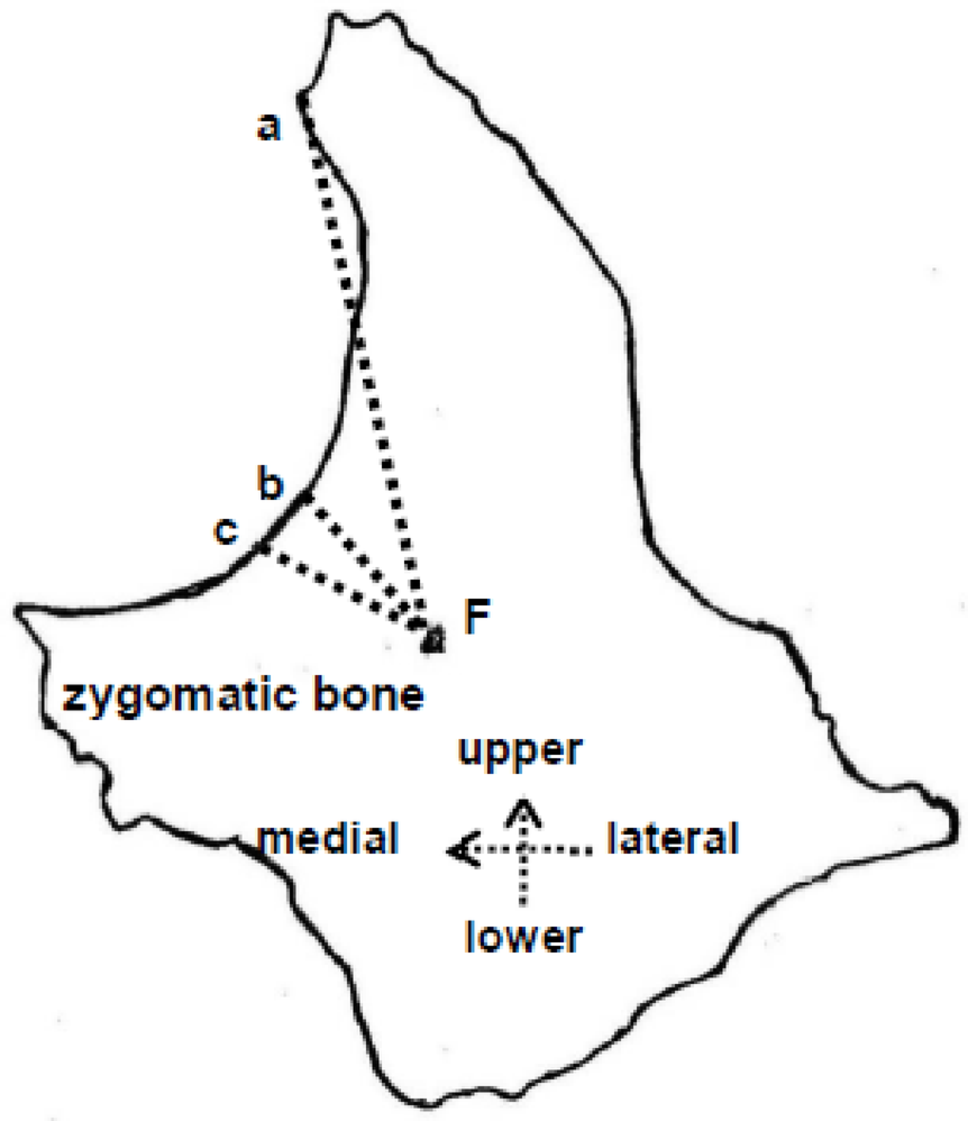 Morphological study of the zygomaticofacial foramen and its location using the distance cross-localization method