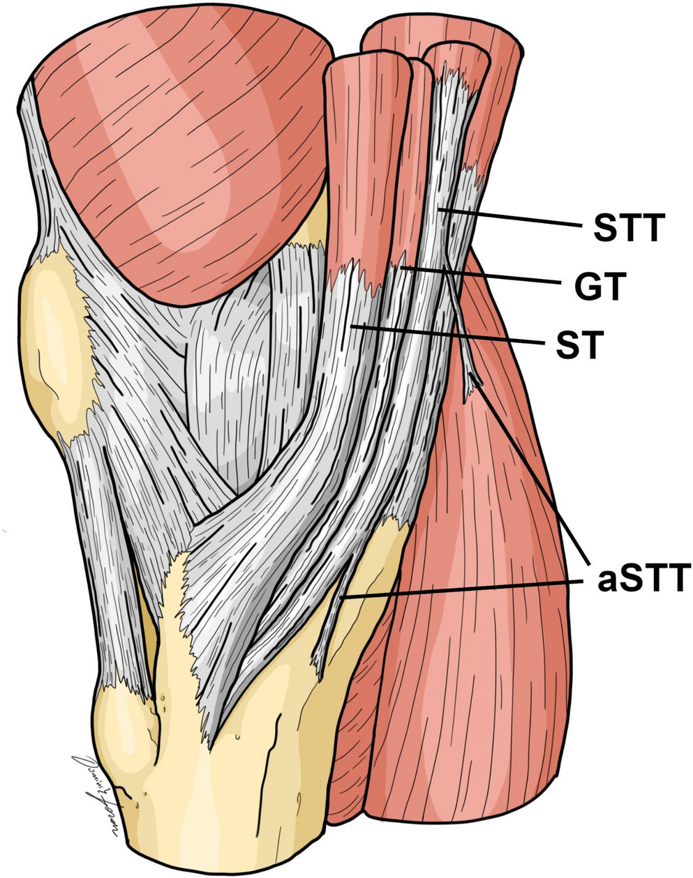 Morphology of the accessory band of the semitendinosus tendon (aSTT): meta-analysis and systematic review