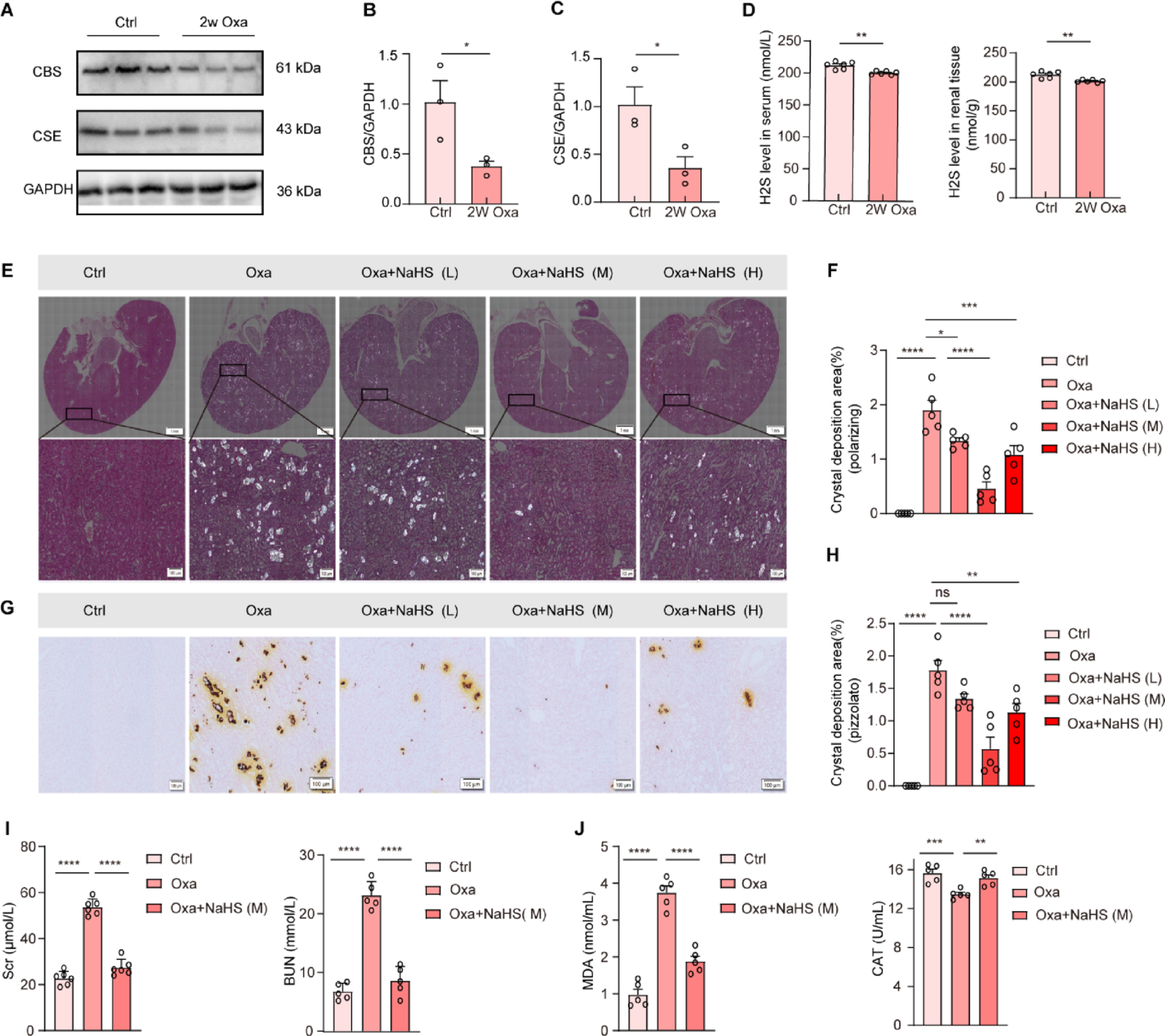 Hydrogen sulfide ameliorates oxalate crystal-related renal injury via inhibiting the activation of NOD-like receptor thermal protein domain associated protein 3 inflammasome in mice
