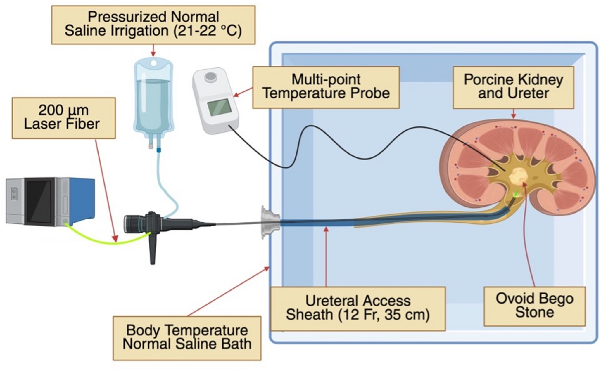 Comparative evaluation of temperature generation during laser lithotripsy: thulium fiber laser, pulsed thulium: YAG, and holmium: YAG with pulse modulation in an ex vivo porcine kidney model