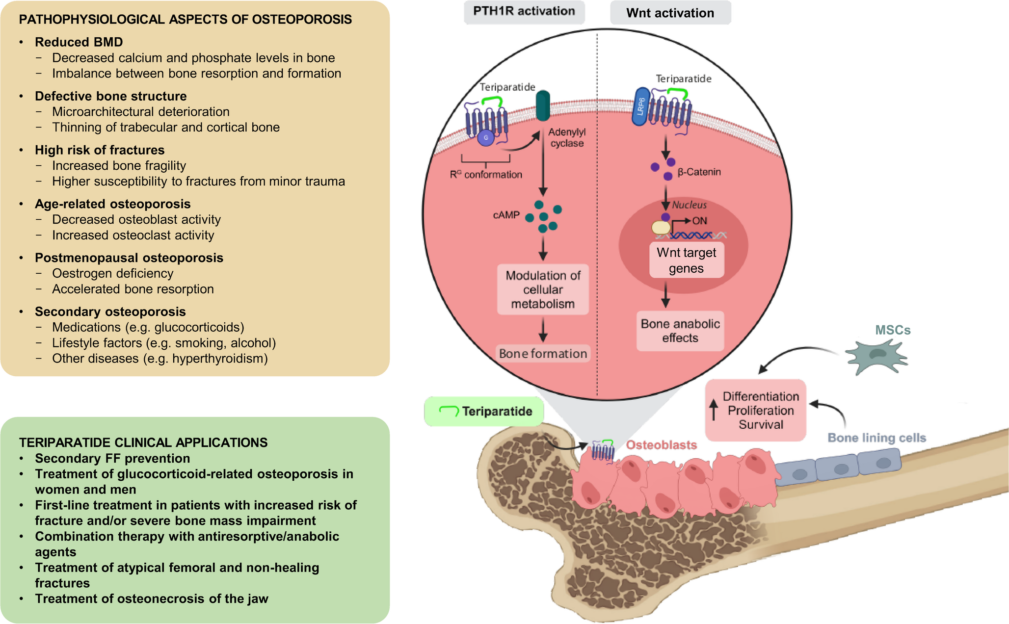Teriparatide in the Prevention and Treatment of Osteoporosis: an Update