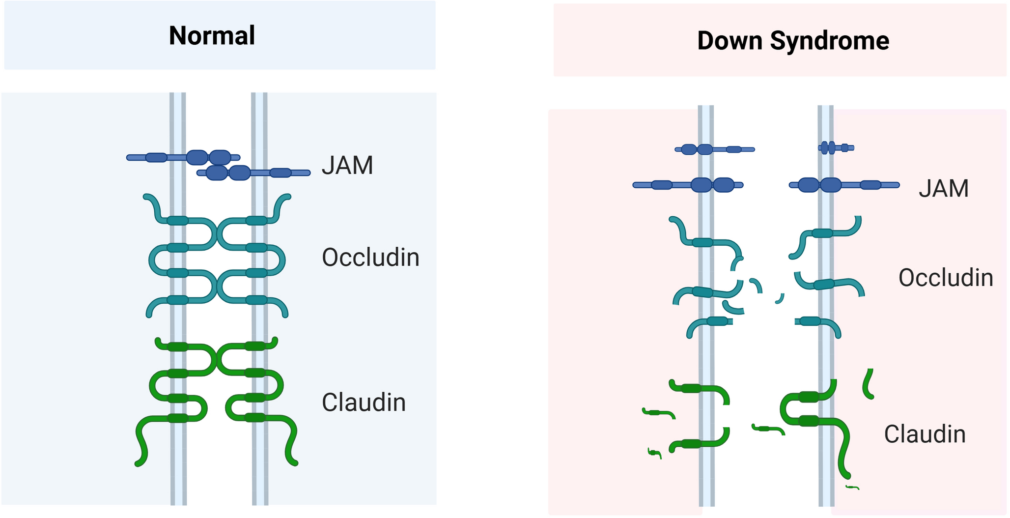 Epithelial Barrier Dysfunction in Down Syndrome: A Gateway to Chronic Lung Injury?