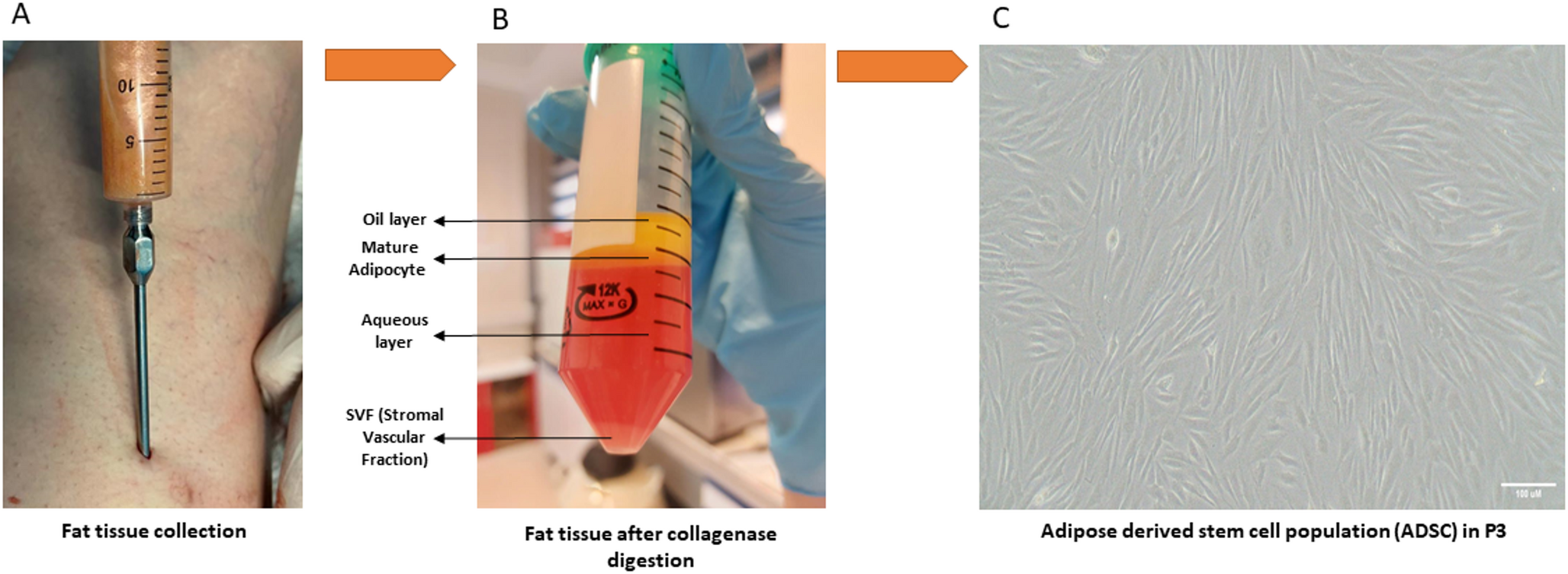 Optimization of Non-Cross-Linked Hyaluronic Acid and Adipose-Derived Mesenchymal Stem Cells for Regenerative Applications: an in Vitro Study