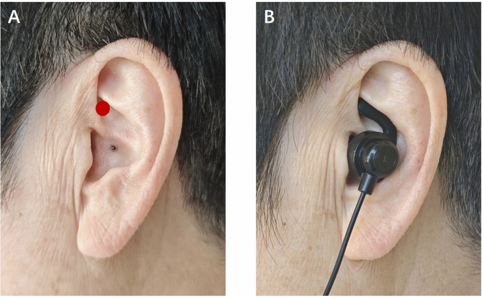 Efficacy of Transcutaneous Auricular Vagus Nerve Stimulation for Postoperative Pain Relief in Patients Undergoing Elective Laparoscopic Gastrointestinal Tumor Surgery