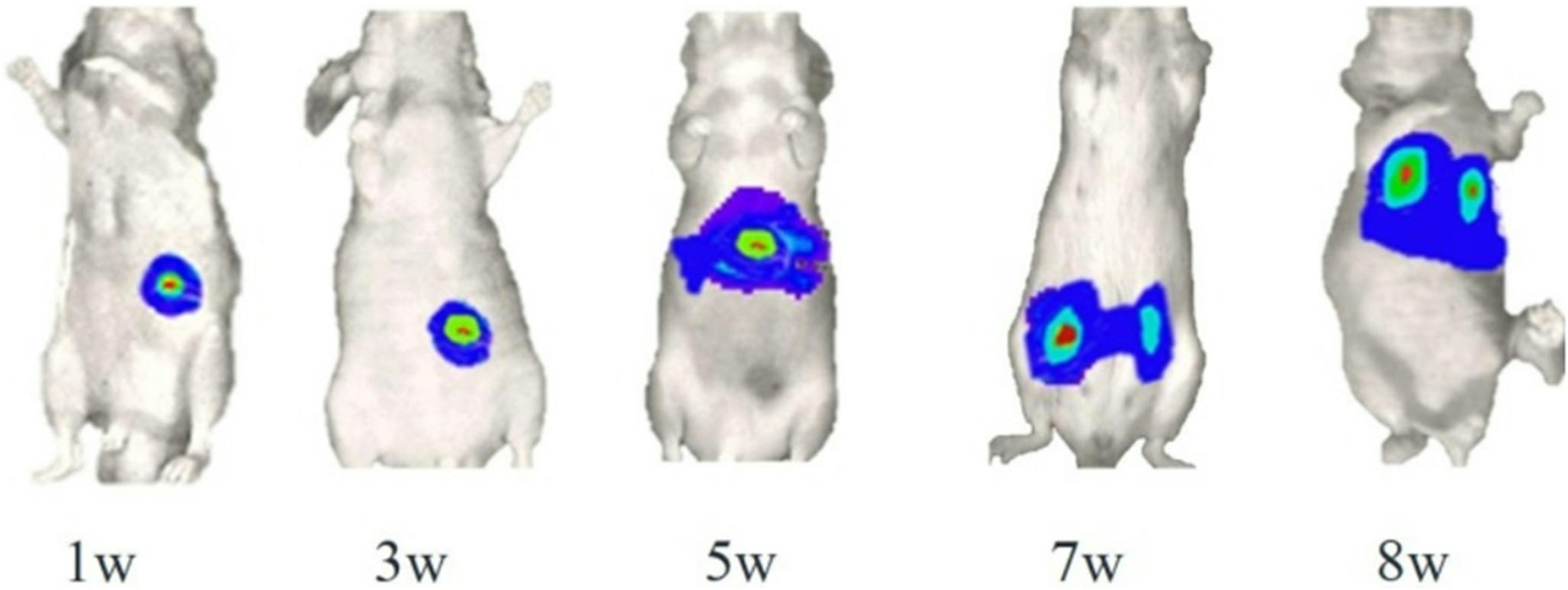 Efficacy of 5-fluorouracil and metronomic chemotherapy mediated ornithine decarboxylase antizyme for inhibiting of colorectal cancer