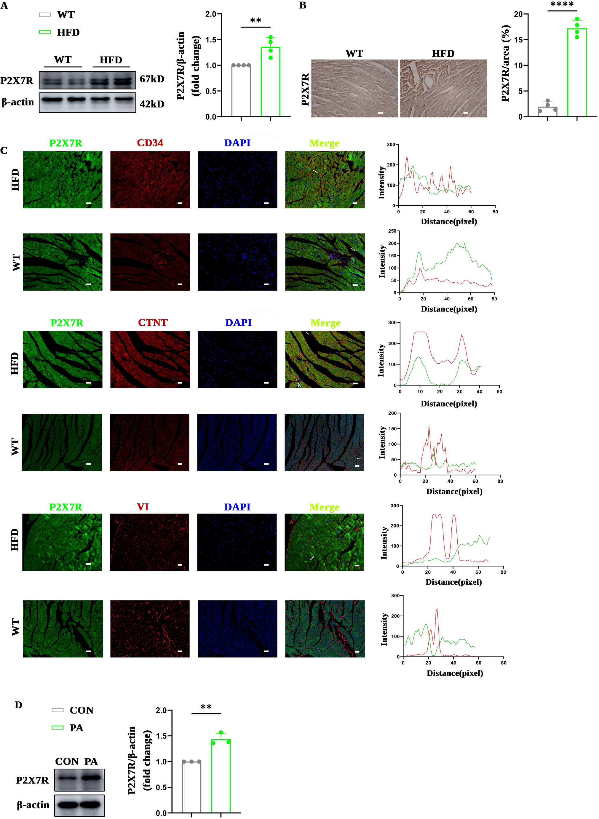 P2 X 7 receptor deficiency ameliorates high-fat-induced cardiac remodeling by improving oxidative stress through PI3K/AKT/GSK3β-mediated regulation of Nrf2