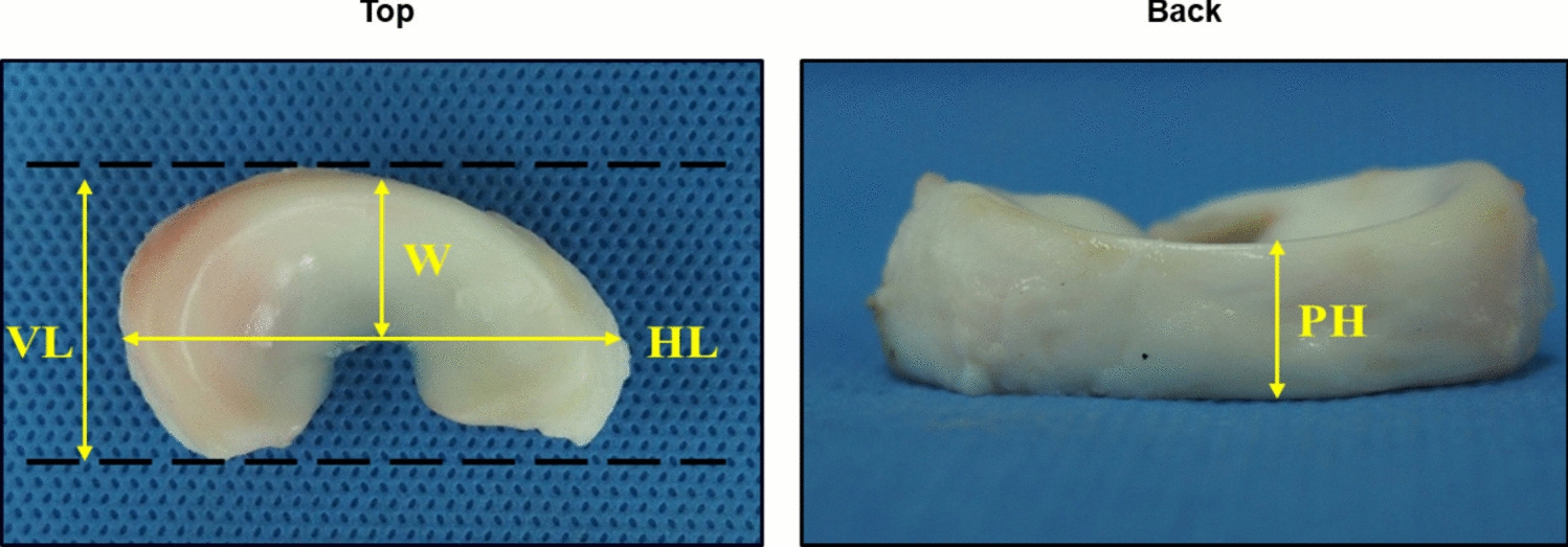 Rapid and Efficient Combined Decellularization with Physical, Chemical and Enzymatic Treatment for Production of Bovine-Derived Meniscal Implant to Replace Damaged Meniscus