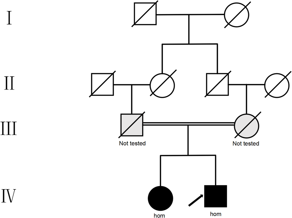 Homozygous NOTCH3 c.3373G > A (p.(Glu1125Lys)) in a consanguineous Chinese family presenting with vestibular migraine and epilepsy: Expanding the genotype–phenotype spectrum