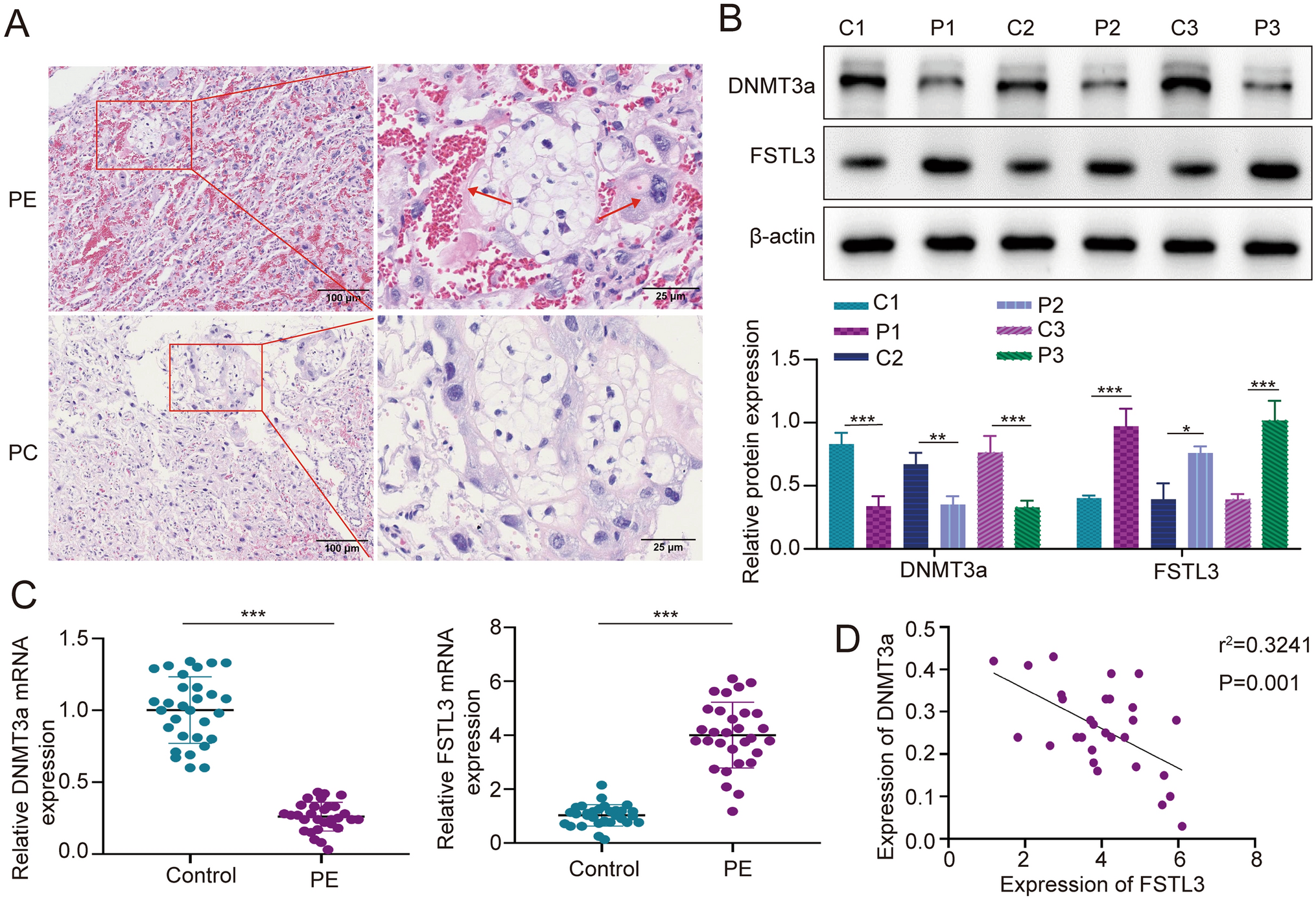 DNMT3a mediates FSTL3 methylation to regulate trophoblast proliferation, migration and invasion