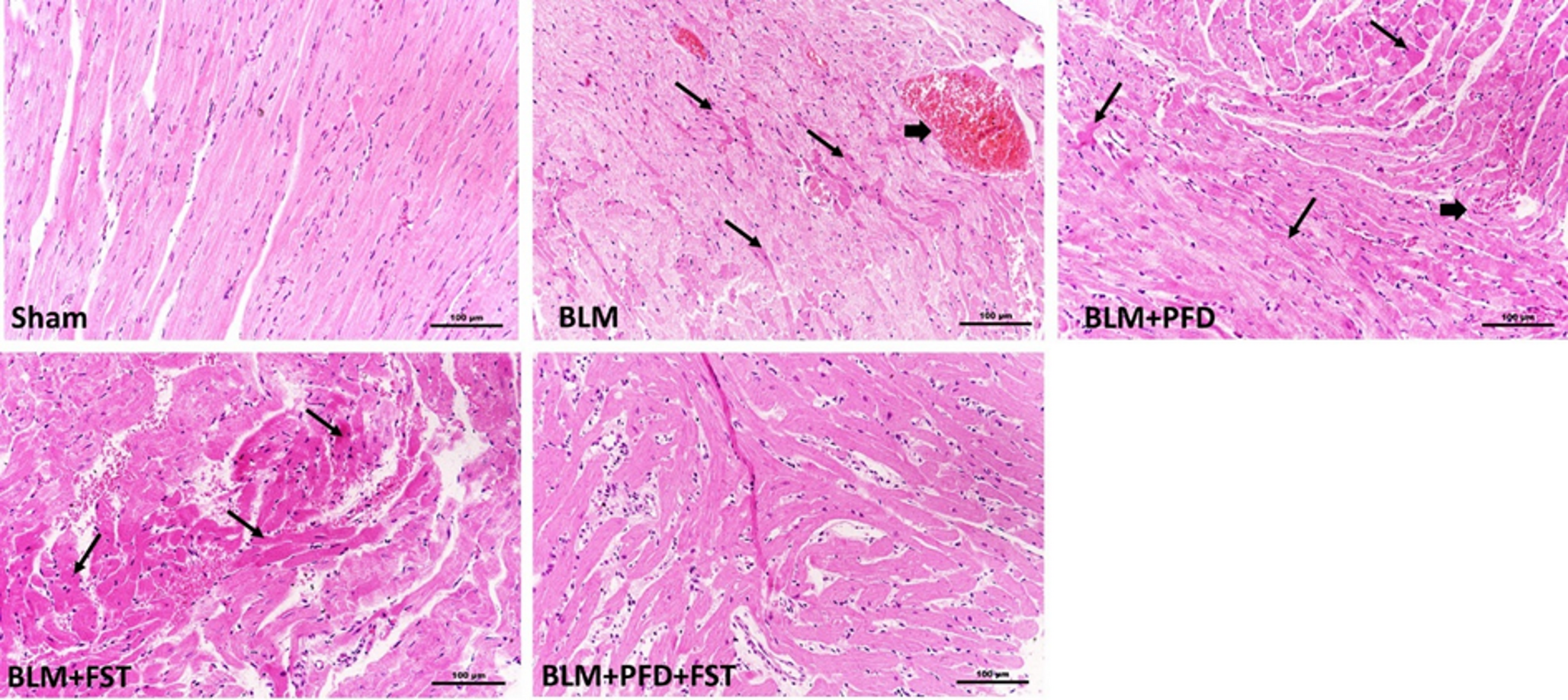 Effects of pirfenidone and fisetin on apoptosis and oxidative stress mechanisms in heart tissue of bleomycin-induced pulmonary fibrosis