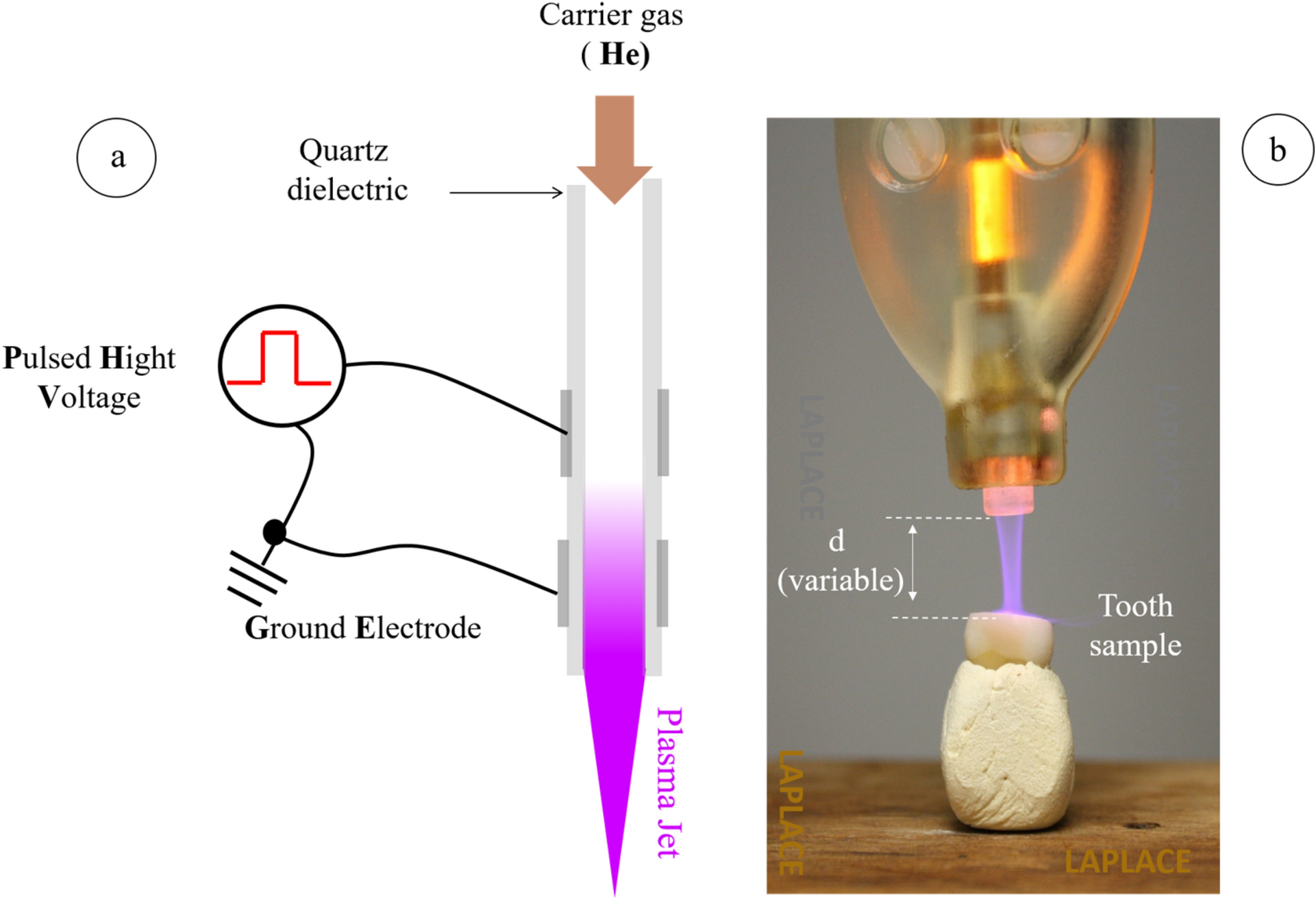 The application of cold atmospheric plasma on human dentin improves its bond strength capacities: an in vitro study