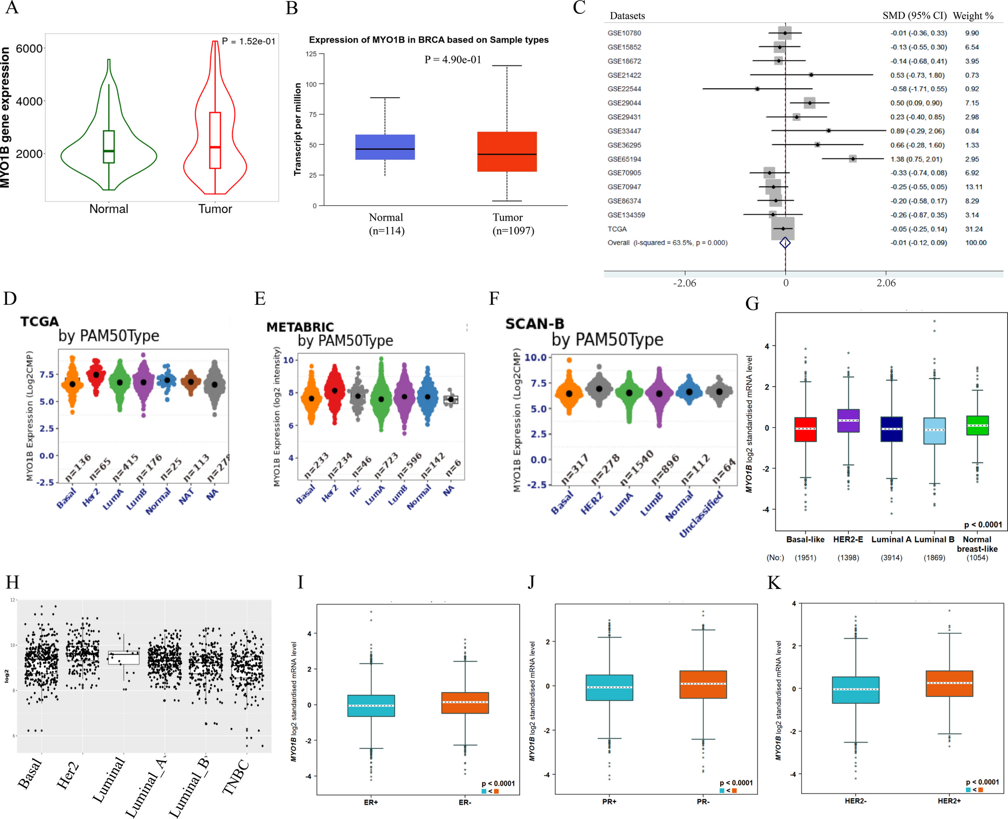 Oncogenic role and potential mechanisms of MYO1B in breast cancer