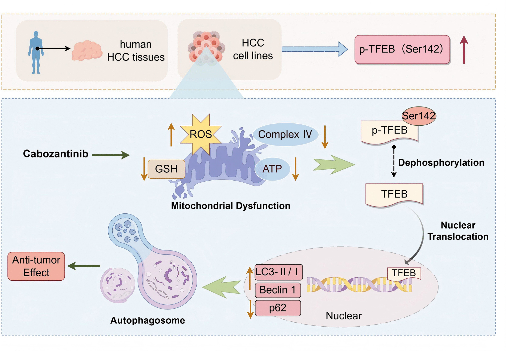 Cabozantinib activates TFEB-mediated autophagy to exert anti-tumor effects in hepatocellular carcinoma