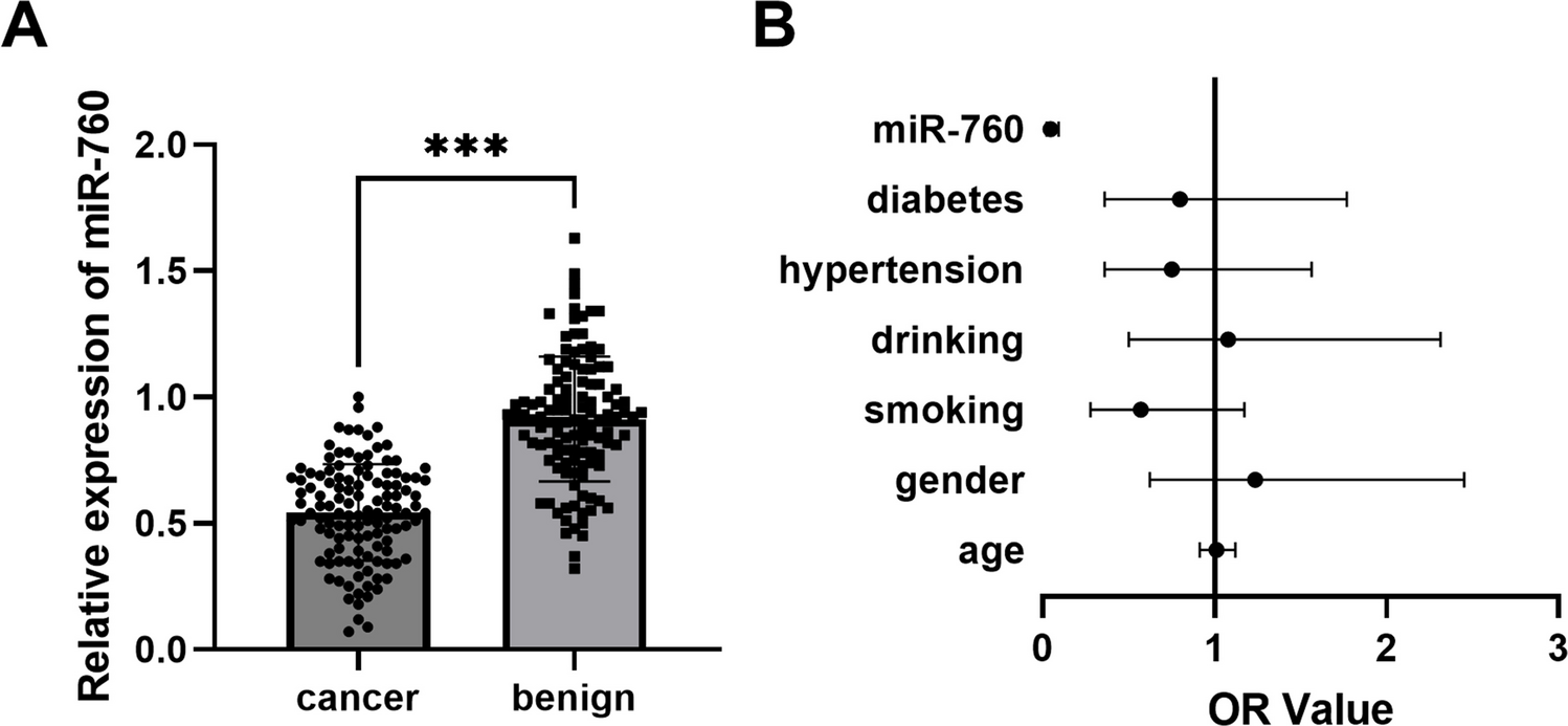 Clinical Effectiveness of miR-760 to Distinguish Benign and Malignant Pulmonary Nodules on the Basis of Low-Dose Spiral CT Imaging
