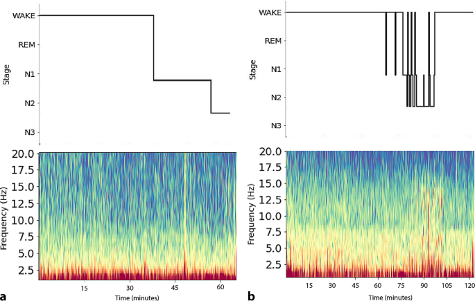 Method for EEG measurement in a human sleeping in a highly concentrated Epsom salt solution (float tank)