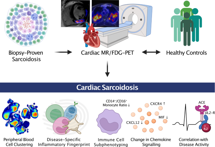 The inflammatory fingerprint reveals immune cell populations associated with disease activity in cardiac sarcoidosis