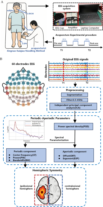 Changes in aperiodic EEG activity following acupuncture stimulation in stroke