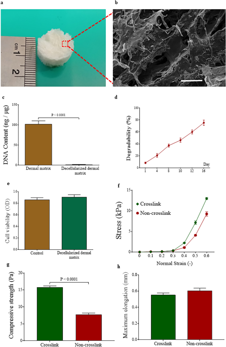 Modulation of angiogenic, inflammatory, and matrix remodeling responses in type 2 diabetic wounds by a decellularized dermal scaffold and adjunct biophysical stimulation