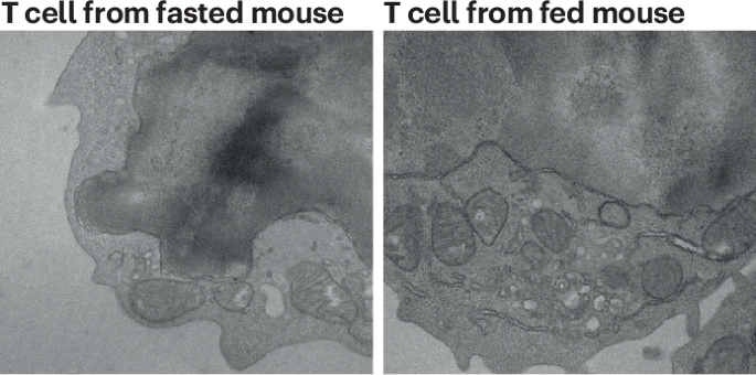 T cell activity is boosted after meals