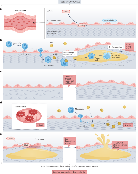 Causes and consequences of discontinuation of GLP1RAs or tirzepatide