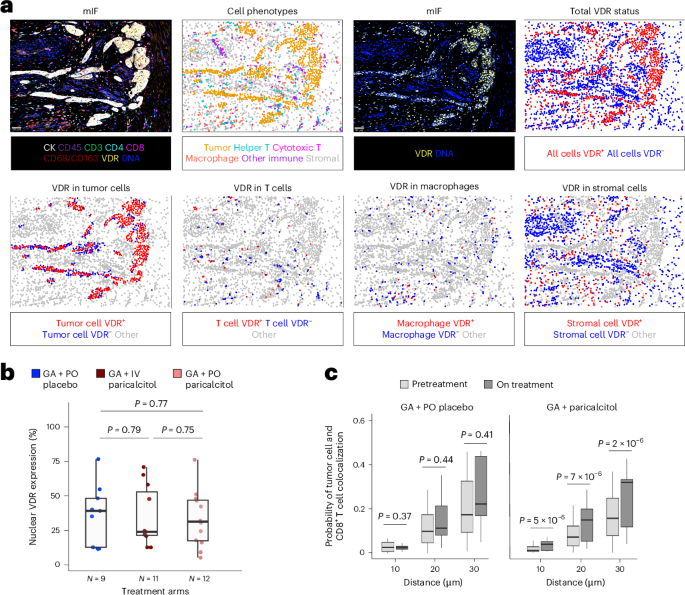 Combination of paricalcitol with chemotherapy shows promise in phase 1 study of metastatic pancreatic cancer