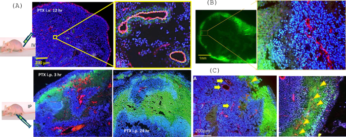 Catheter based intraperitoneal chemotherapy using taxane for peritoneal metastases from gastric cancer: from bench to bedside—a narrative review