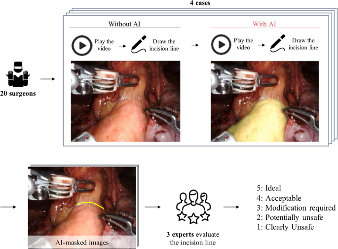 Artificial intelligence–based anatomical recognition improves surgeon decision-making during robotic gastrectomy