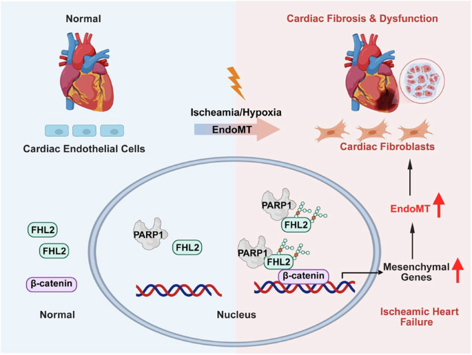 Endothelial PARP1 orchestrates endothelial-to-mesenchymal transition via the PARylation of FHL2 in ischaemic heart failure
