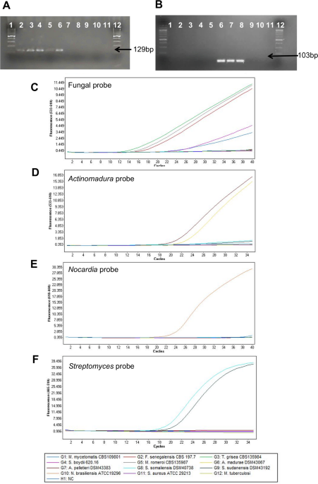 A qPCR identification scheme to differentiate actinomycetoma from eumycetoma
