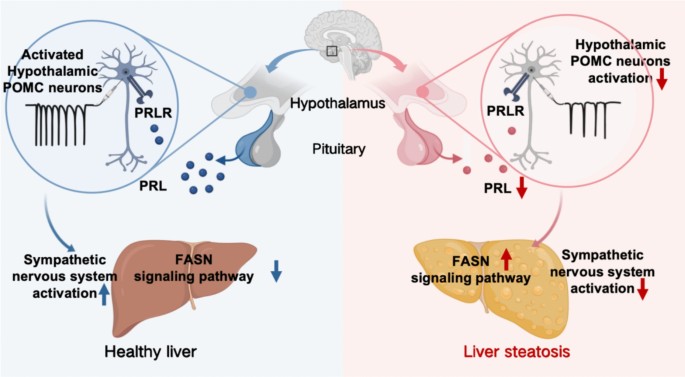 Prolactin acts on proopiomelanocortin neurons to regulate hepatic lipid metabolism