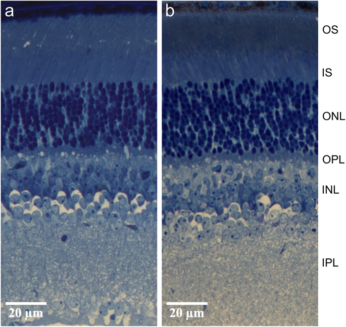 E122Q rhodopsin: pigment microspectrophotometry, photoreceptor light responses, and bleaching adaptation