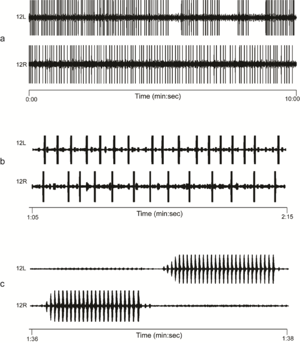 Testosterone and estradiol predict male calling performance, but not performance-related tradeoffs, in competitive signaling environments in Cope’s gray treefrogs ()