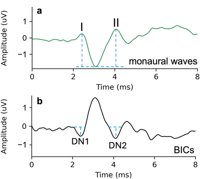 The effects of interaural time and level differences on the binaural interaction component of the auditory brainstem response in Cope’s gray treefrogs